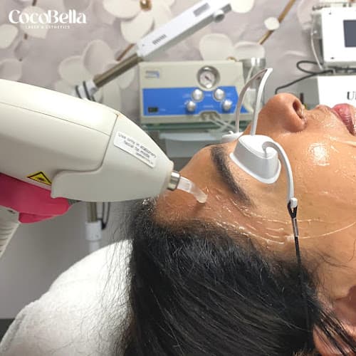 CocoBella Laser & Esthetics