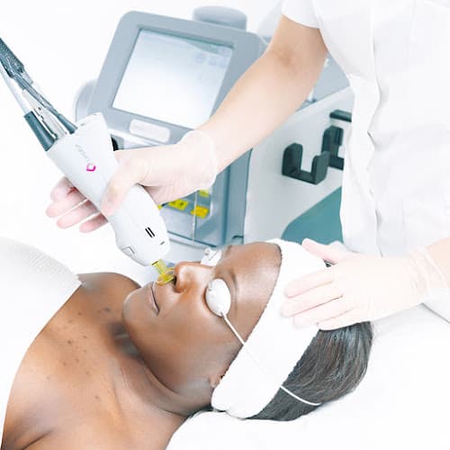 Northern Virginia Hair Laser