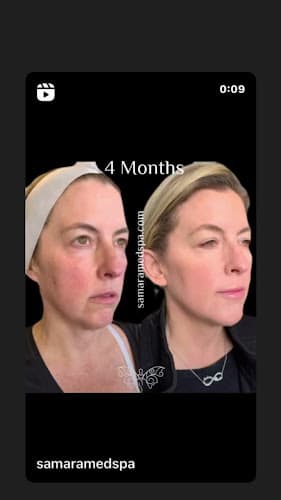 Samara MedSpa Glastonbury