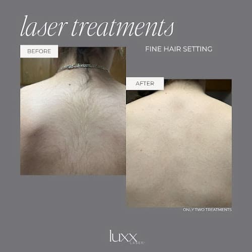 Luxx Laser Spa