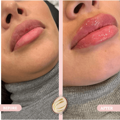 Creole Contour Aesthetics